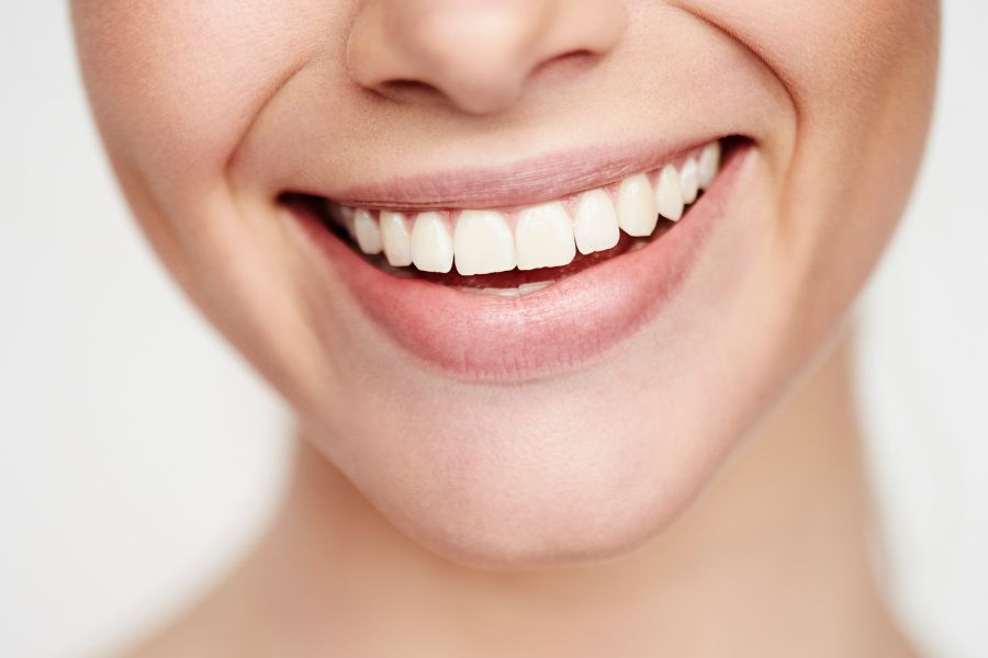 Sonrisa Gingival