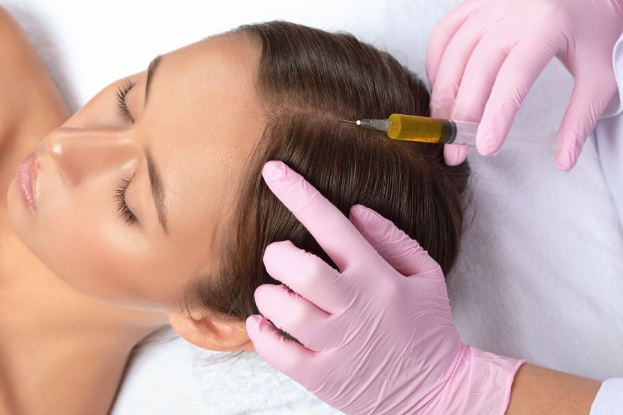 mesoterapia capilar mesoterapia capilar